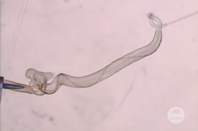 Microscopic view of insect genetalia