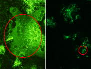 Cells infected with Hendra virus (left) and with Cedar virus (right). 