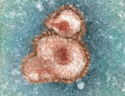 An artificially coloured electron micrograph of the new SARS-like virus – now known as the Middle East Respiratory Syndrome (MERS) – which has caused an ongoing outbreak of respiratory disease and has spread from the Middle East to the United Kingdom, Germany, France, Italy and Tunisia.