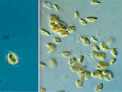 Test organism used for sediment toxicity assessment - the benthic alga _Entomoneis punctulata_