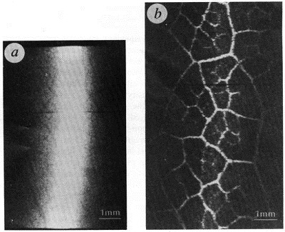 A comparison between a radiograph (a) and a phase-contrast image (b) of a leaf (_Eucalyptus mellodora_) using a fixed-angle analyser crystal with offset estimated to be of the order of  a few arcsec