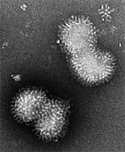 Electron micrograph of influenza A virus particles