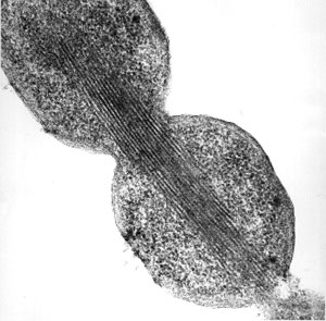 Electro micrograph of potyvirus-like particles formed inside the cells of _Escherichia coli_ bacteria that are overexpressing the potyvirus coat protein