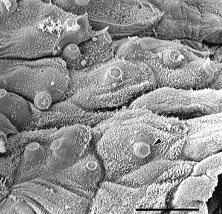 Scanning electron micrograph of infected skin with fungal discharge tubes protruding through the surface