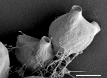 Scanning electron micrograph of two sporangia with open discharge tubes