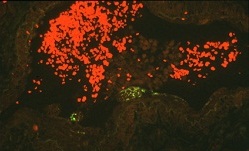 Slide of a cross section of a blood vessel taken from the lung of an infected horse