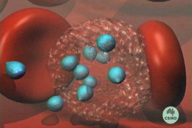 Graphic of Malaria virus attacking red blood cells.