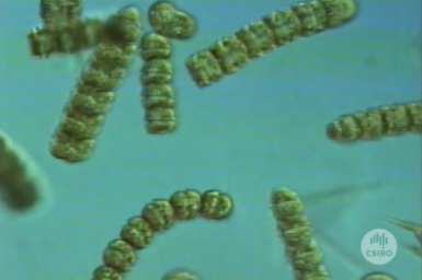 Microscopic view of algae.